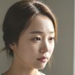 여성 탈모 원인과 치료 방법 33