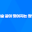 입술 끝이 찢어지는 원인과 치료방법 19