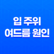 입 주위 여드름 원인과 치료법, 예방법 알아보기 21