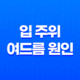 입 주위 여드름 원인과 치료법, 예방법 알아보기 21