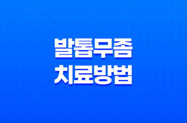 발톱무좀 치료방법, 발톱에 생기는 피부사상균 침투 질환 25