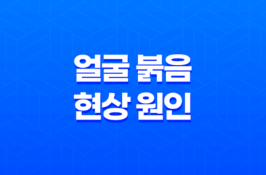 얼굴 붉음 현상 원인과 해결방법 17