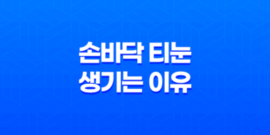 손바닥 티눈 생기는 이유와 제거하는 방법 31