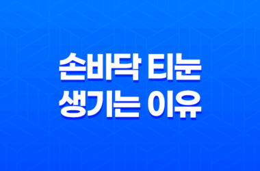 손바닥 티눈 생기는 이유와 제거하는 방법 29