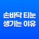 손바닥 티눈 생기는 이유와 제거하는 방법 25