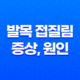 발목 접질림 증상, 원인, 치료방법, 예방법에 대한 모든 것 27
