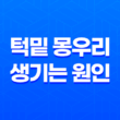 턱밑 몽우리 생기는 원인 4가지 33