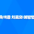 흑색종 치료와 예방법을 알아보자! 27
