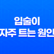 입술이 자주 트는 원인과 대처법 39
