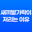 새끼발가락이 저리는 이유와 해결책, 발가락 저림 증상 29