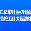 다래끼 눈꺼풀에 생기는 염증성 질환의 원인과 치료법 33