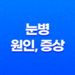 눈병 원인, 증상, 치료방법, 전염경로, 예방법 21