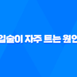 입술이 자주 트는 원인과 대처법 39