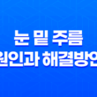 깊어진 눈 밑 주름, 원인과 해결방안 21