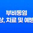 부비동염 증상, 치료 및 예방법 15