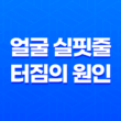 얼굴 실핏줄 터짐의 원인 19