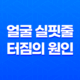 얼굴 실핏줄 터짐의 원인 19