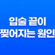 입술 끝이 찢어지는 원인과 치료방법 19