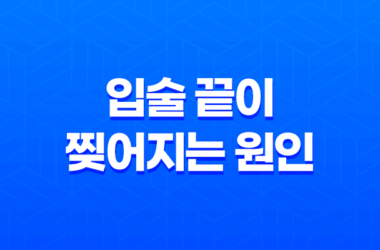 입술 끝이 찢어지는 원인과 치료방법 21