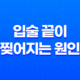 입술 끝이 찢어지는 원인과 치료방법 17
