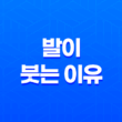 발이 붓는 이유, 원인 및 효과적인 관리 방법 27