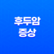 후두암 초기증상 및 원인, 치료법 정리 23