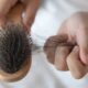 탈모 의심 증상과 예방법 19