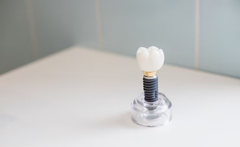 임플란트의 가격과 보험 적용