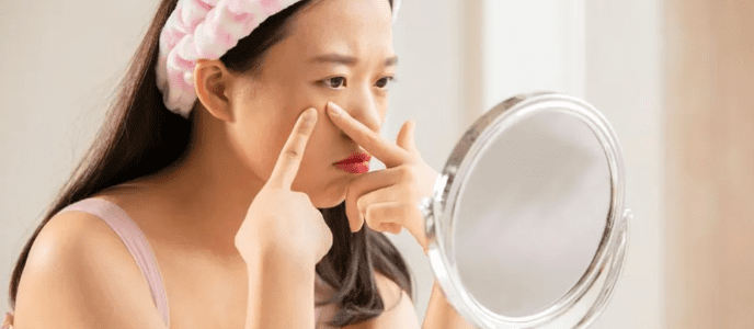 겨울철 여드름 관리: 건강한 피부를 유지하는 전략 4 겨울철 여드름 관리: 건강한 피부를 유지하는 전략 3