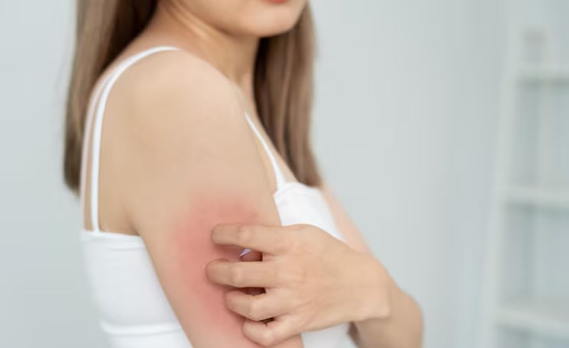 대상포진 보험 - 어떻게 선택해야 할까요?