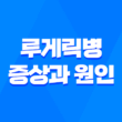 루게릭병 증상과 원인 - 치료법과 예방 방법까지 3