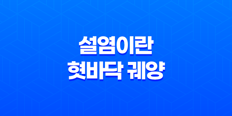 설염이란, 혓바닥 궤양과 염증 7
