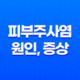 피부주사염 원인, 증상, 치료방법, 관리방법 23