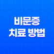 비문증, 눈 속 유리체 혼탁으로 인한 시력 이상 17