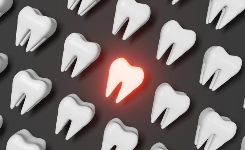 사랑니 발치 후 주의사항