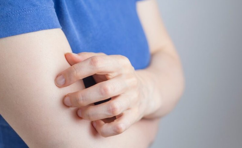 대상포진의 치료법: 조기에 대처가 필수