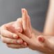 6가지 효과적인 손가락 관절염 치료 및 예방 방법 23