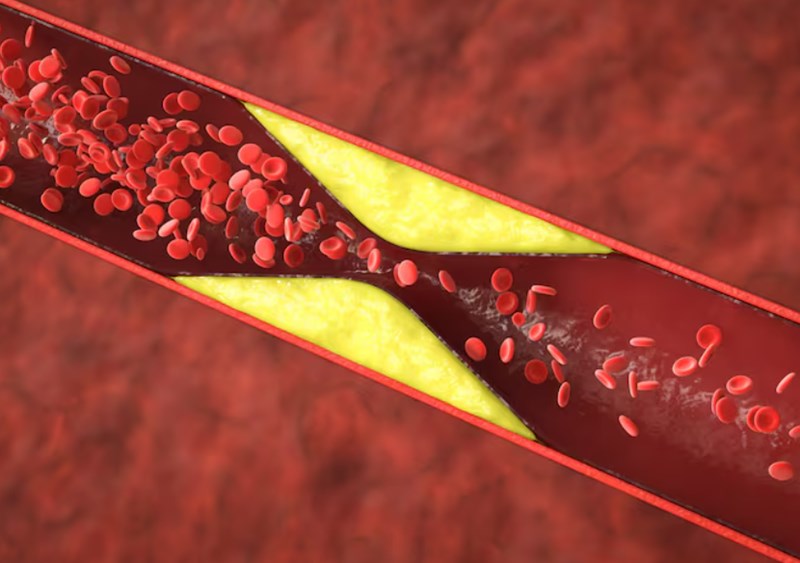 고지혈증에 도움을 주는 음식 8 고지혈증에 도움을 주는 음식 7