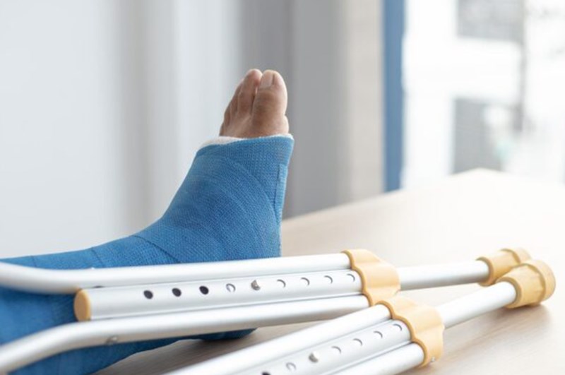 골절 보험 10가지 정보 - 골절 사고 시 보상받는 방법 32 골절 보험 10가지 정보 - 골절 사고 시 보상받는 방법 31