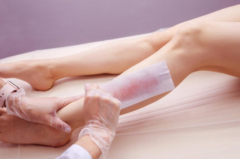 브라질리언 왁싱 효과, 통증, 디자인, 가격, 왁싱 후 관리 10 브라질리언 왁싱 효과, 통증, 디자인, 가격, 왁싱 후 관리 9