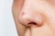 코안 뾰루지 원인과 해결방법 6