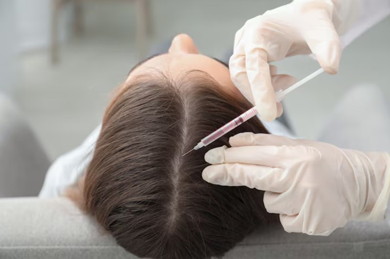 모발이식 수술 비용과 병원 고르는 방법 7