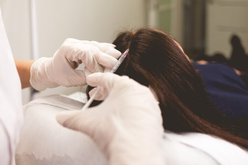 모발이식 수술 비용과 병원 고르는 방법 11