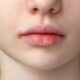 입병 낫는 법 7가지, 입술 상처 및 염증 치료 방법 13