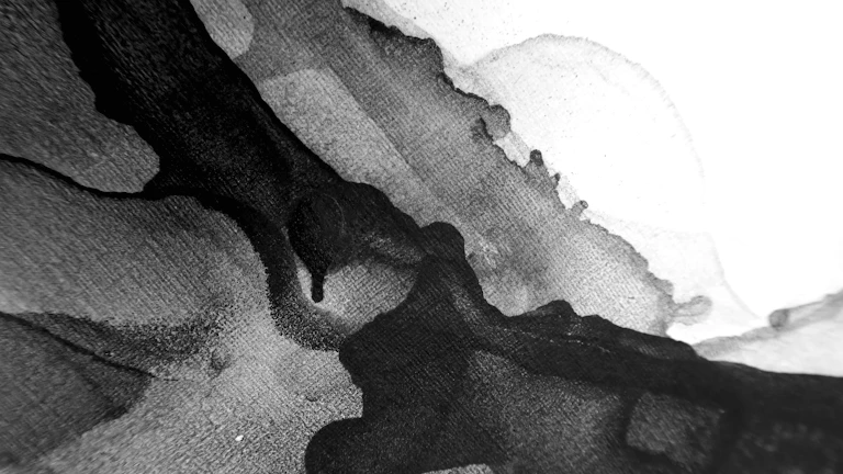 임플란트 치조골 이식 수술비 2종 vs 3종 지급 금액 차이, 정확히 알고 가입하세요! 8 치조골 이식 수술 모습