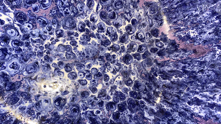 표적항암약물허가치료비 특약 필요성 실제 항암 치료 비용과 보험금 비교 7 현미경으로 본 암세포