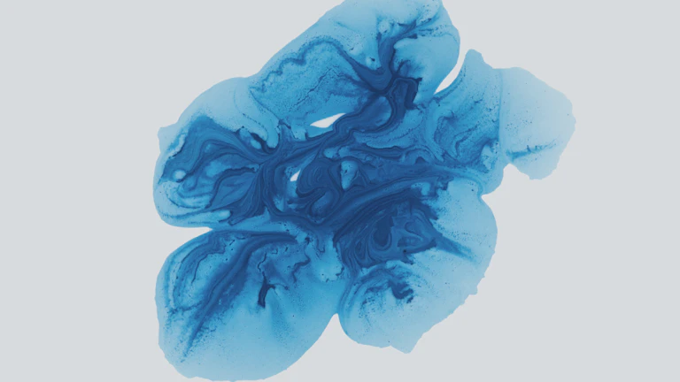 뇌동맥류 후기 지급 거절 실전 대처법 3