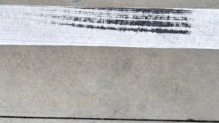 실비 보험료 인상 실제 사례 분석 할증 한계 돌파구 8 병원비 영수증과 계산기