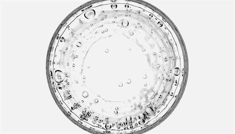 질병수술비 1-5종 보장 비교 분쟁 금감원 민원 성공 사례 1