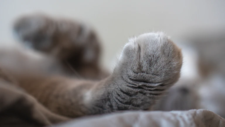 하지정맥류 수술비 전액 받는 비결 7 다리 통증으로 고통받는 사람의 모습